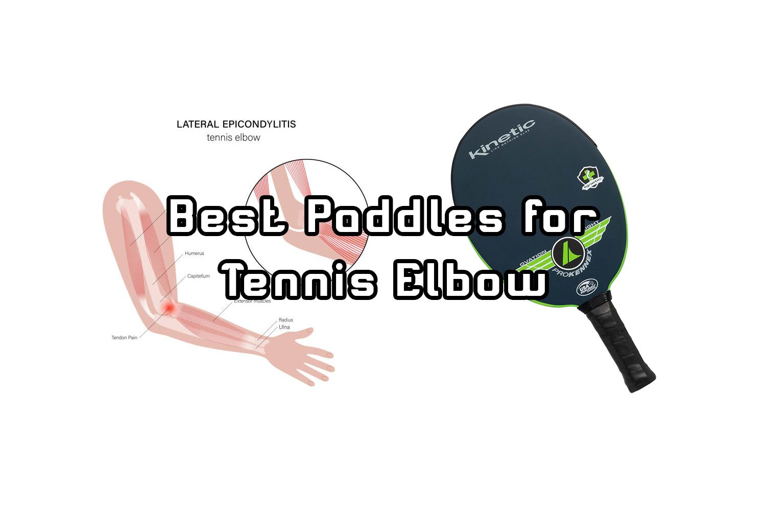 The Best Pickleball Paddle for Tennis Elbow A Comprehensive Guide